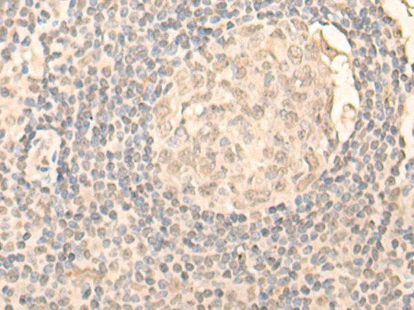 Rabbit Polyclonal Antibody to NOLC1