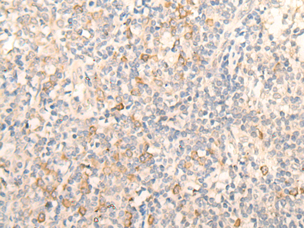 Rabbit Polyclonal Antibody to BZW2