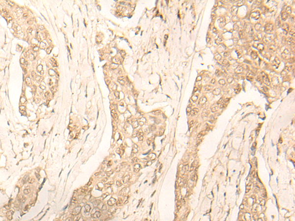 Rabbit Polyclonal Antibody to FAH