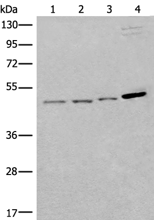 Rabbit Polyclonal Antibody to SPOCK3