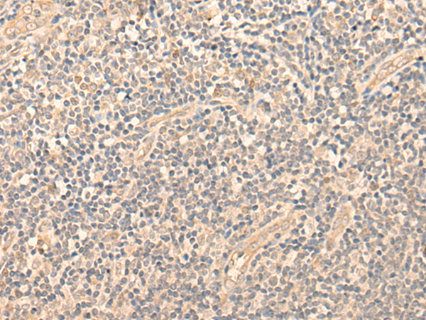 Rabbit Polyclonal Antibody to NCAPG