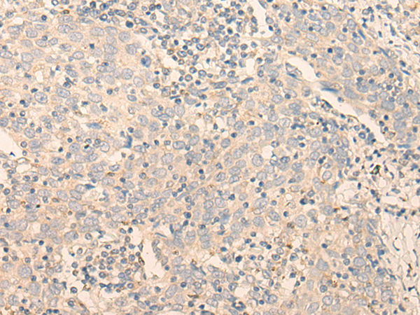 Rabbit Polyclonal Antibody to GCDH