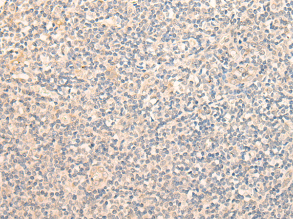 Rabbit Polyclonal Antibody to GCNT3