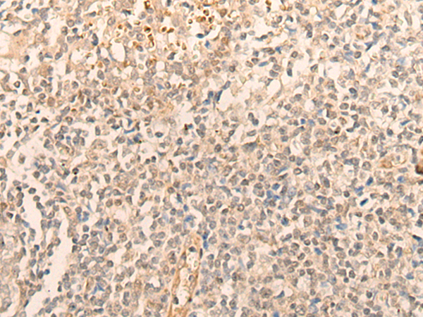 Rabbit Polyclonal Antibody to IFRD2