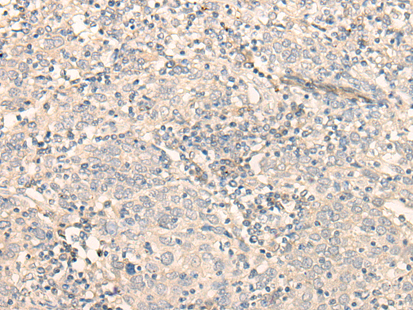 Rabbit Polyclonal Antibody to FADS3