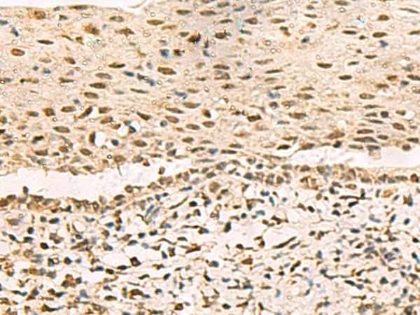 Rabbit Polyclonal Antibody to GRWD1