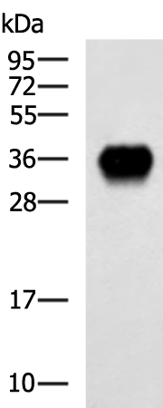 Rabbit Polyclonal Antibody to FOLR1