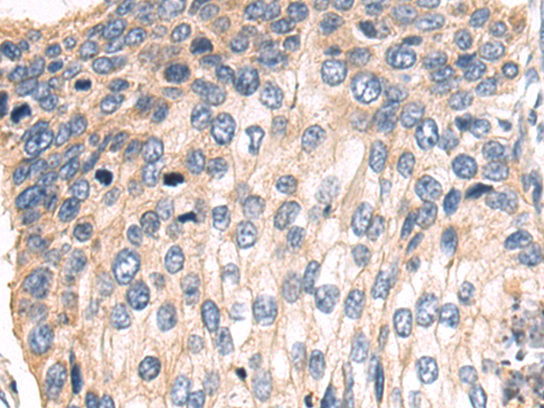 Rabbit Polyclonal Antibody to IFNB1