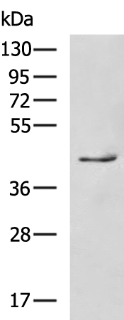 Rabbit Polyclonal Antibody to CSF1