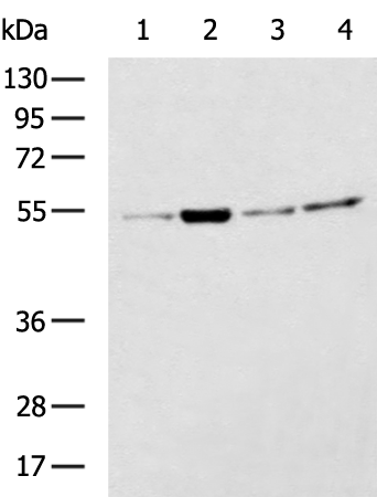 Rabbit Polyclonal Antibody to TUBA1B