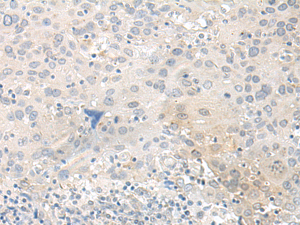 Rabbit Polyclonal Antibody to TUBG2