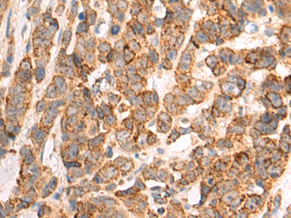 Rabbit Polyclonal Antibody to TUFM