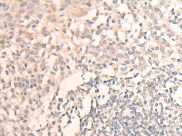 Rabbit Polyclonal Antibody to MLLT6