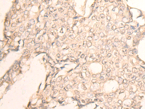 Rabbit Polyclonal Antibody to RUVBL2