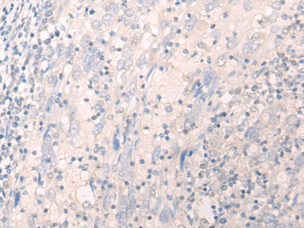 Rabbit Polyclonal Antibody to LILRA2