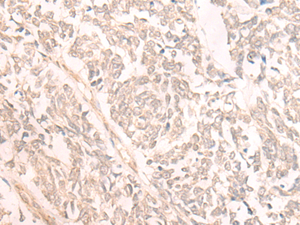 Rabbit Polyclonal Antibody to TBC1D2