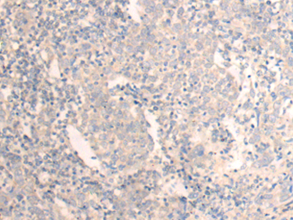Rabbit Polyclonal Antibody to SAMM50