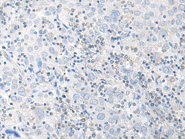 Rabbit Polyclonal Antibody to EIF2S3