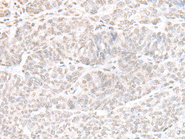 Rabbit Polyclonal Antibody to GPBP1L1