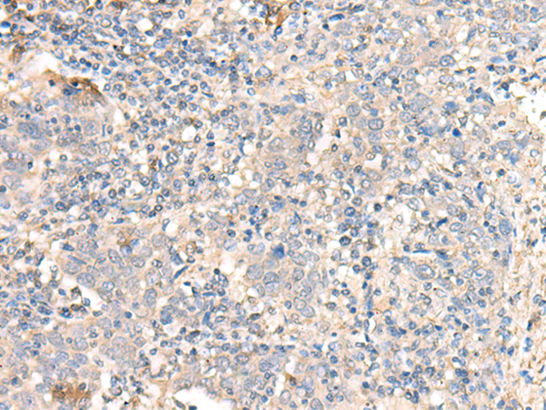 Rabbit Polyclonal Antibody to PARS2