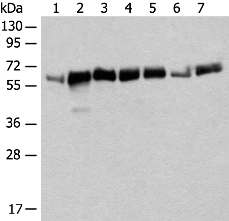 Rabbit Polyclonal Antibody to CCDC47