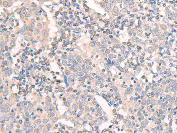 Rabbit Polyclonal Antibody to BPIFB1
