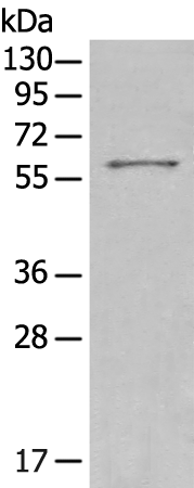 Rabbit Polyclonal Antibody to IFIT3
