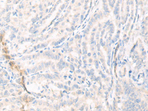 Rabbit Polyclonal Antibody to KCNS3