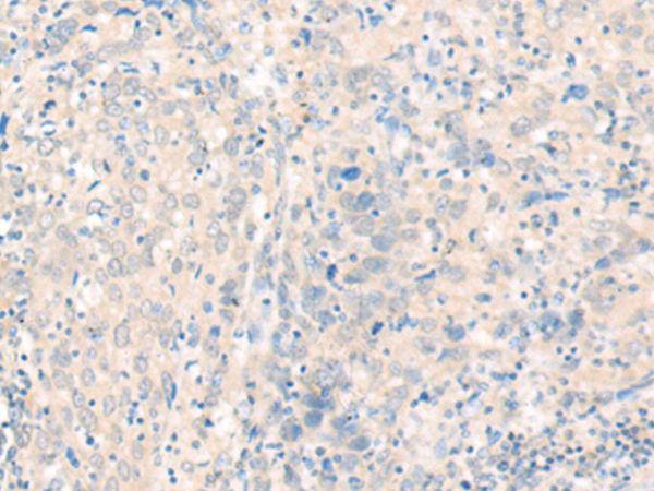 Rabbit Polyclonal Antibody to PDZD3