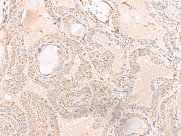 Rabbit Polyclonal Antibody to IGHA1