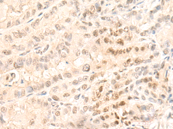 Rabbit Polyclonal Antibody to GTF2F1