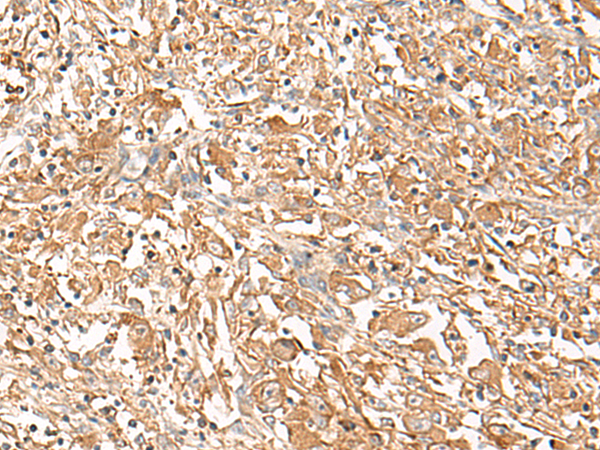 Rabbit Polyclonal Antibody to CORO2A