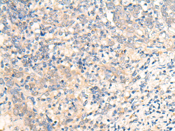 Rabbit Polyclonal Antibody to COG4