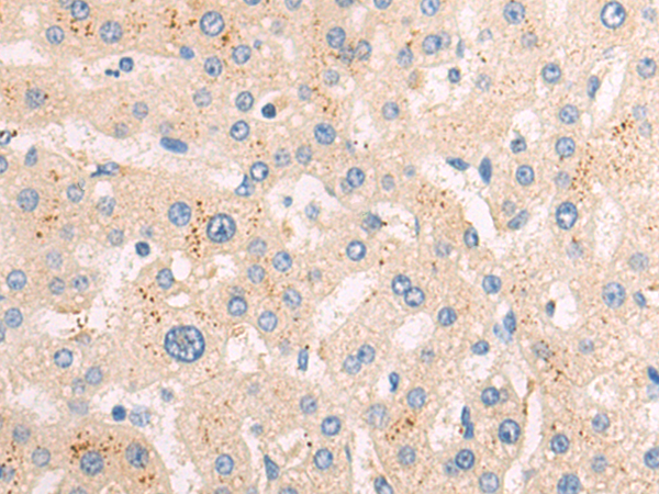 Rabbit Polyclonal Antibody to ATP5F1A