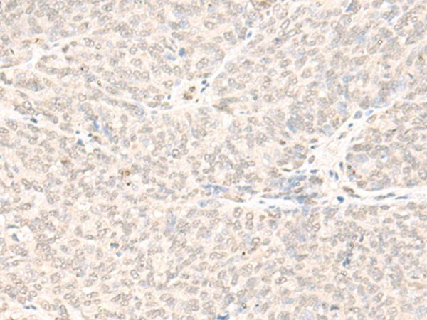 Rabbit Polyclonal Antibody to FTSJ3