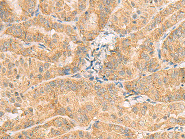 Rabbit Polyclonal Antibody to NCOA4