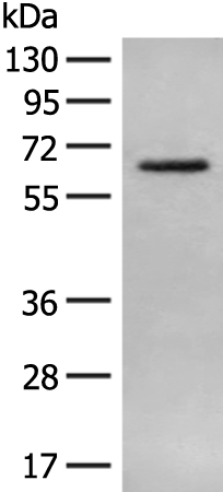 Rabbit Polyclonal Antibody to AOAH