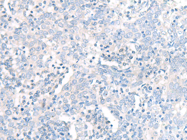 Rabbit Polyclonal Antibody to QARS1