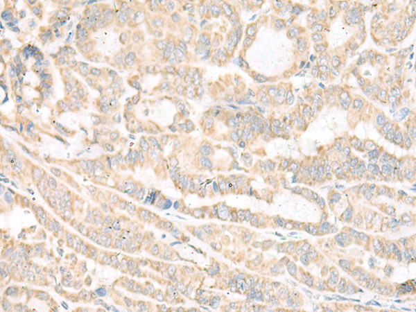 Rabbit Polyclonal Antibody to ACSF2