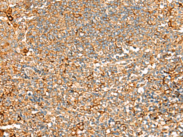 Rabbit Polyclonal Antibody to ASMTL