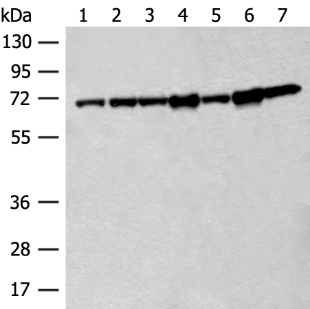 Rabbit Polyclonal Antibody to HSPA2
