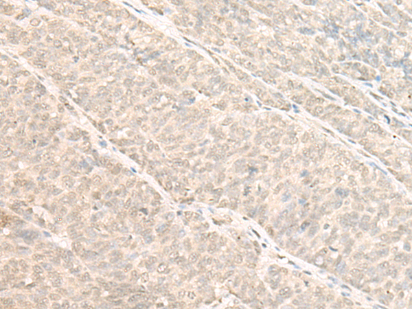 Rabbit Polyclonal Antibody to TRMT1