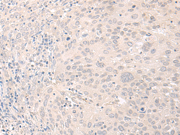 Rabbit Polyclonal Antibody to FOXRED2