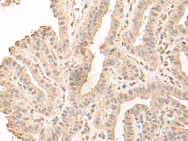 Rabbit Polyclonal Antibody to SAP130