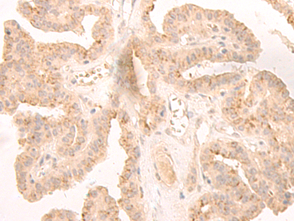 Rabbit Polyclonal Antibody to LCMT2