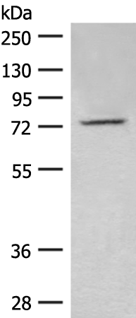 Rabbit Polyclonal Antibody to ZBED1