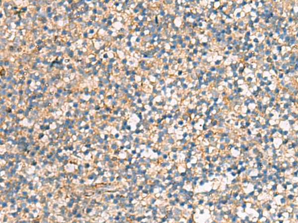 Rabbit Polyclonal Antibody to KIF2C
