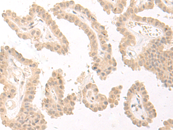 Rabbit Polyclonal Antibody to PBXIP1