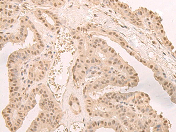 Rabbit Polyclonal Antibody to CNOT10