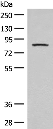 Rabbit Polyclonal Antibody to PFKM